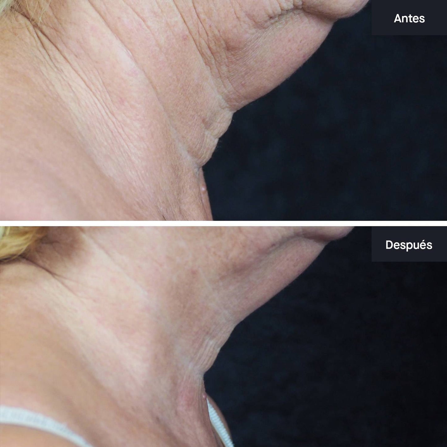 Crema Rejuvenecedora de Cuello y Escote Extracto Divino