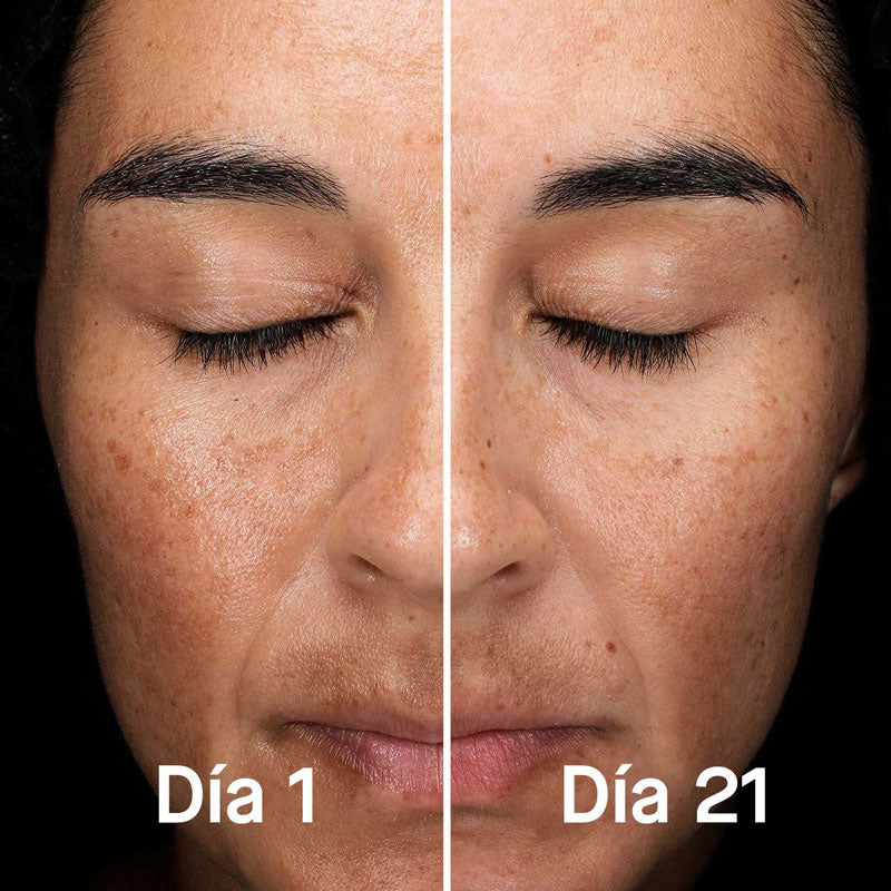 Sérum Concentrado Antigrasa