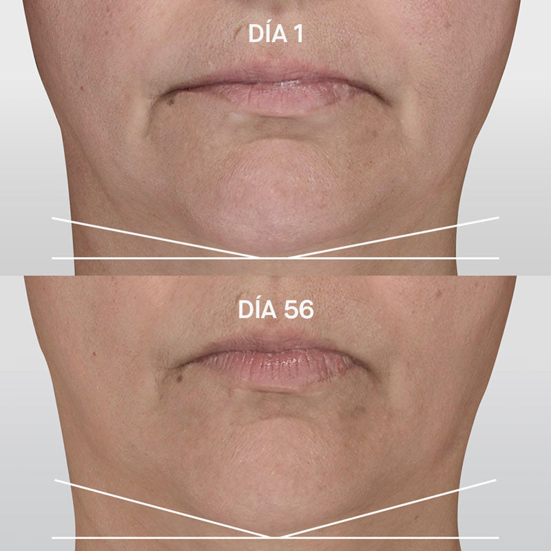 Genactive Serum Reafirmante Antigravedad